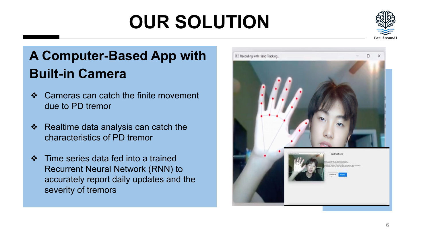 ParkinsonAI prototype using a camera to track hand landmarks